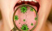 ویروس کرونا چه تاثیری بر دهان و دندان می‌گذارد؟