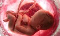 انتقال کرونا از مادر به نوزاد از طریق جفت/ جهش ویروس در بدن نوزاد