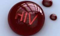 راهی جدید برای درمان ایدز (HIV) کشف شد