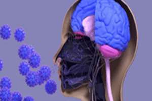 شواهد جدیدی در مورد تاثیر عفونت بینی بر پیشروی آلزایمر