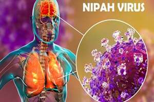 درباره ویروس نیپا چه می‌دانیم؟